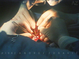Anastomosis-4T1982-AZdravic 300
